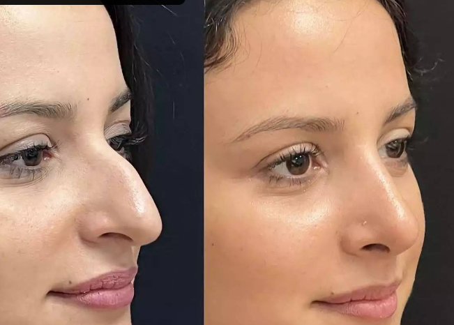 أفضل عيادة تجميل في دبي – بوتوكس، شد الوجه وشفط الدهون
